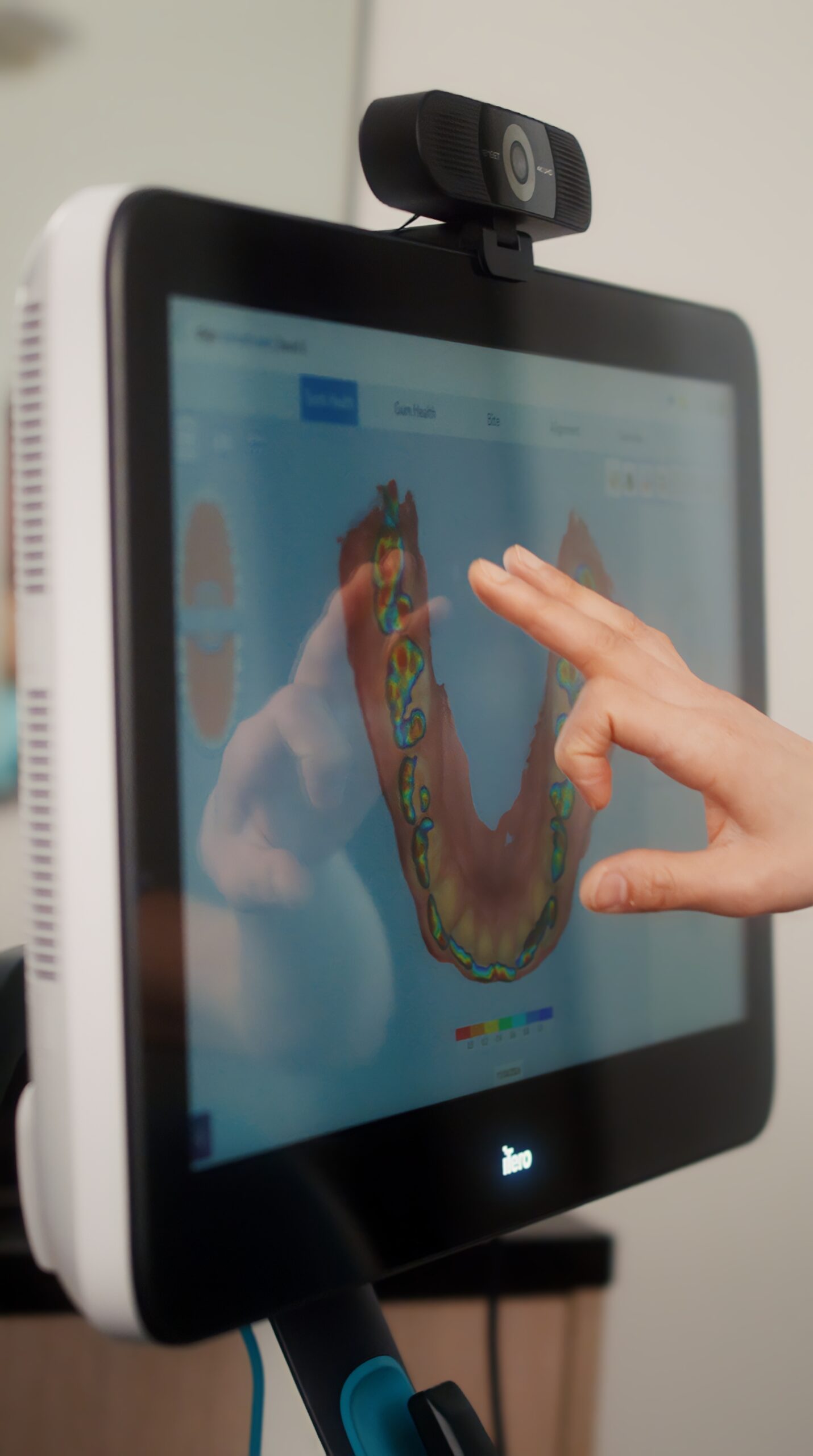 iTero digital scan showing a 3D colour map of a patient’s teeth at SmileCraft Dental